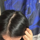 Scalp condition after - Khushi Singhania