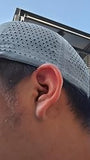 Scalp condition after - Abdul Ali