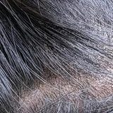 Scalp condition after - Tanvi Sen