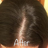Scalp condition after - Kavita Nambiar