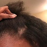 Scalp condition after - Ishita Banerjee