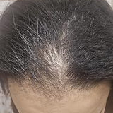 Scalp condition after - Priya Sharma