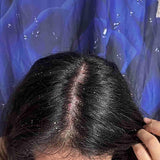 Scalp condition before - Khushi Singhania