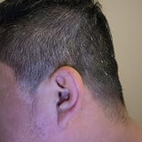 Scalp condition before - Abdul Ali