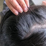 Scalp condition before - Tanvi Sen